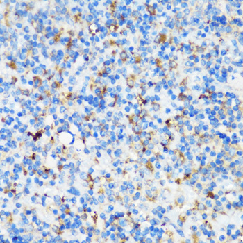 Immunohistochemistry - ELP3 Polyclonal Antibody 