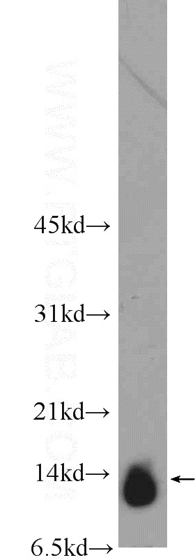 mouse brain tissue were subjected to SDS PAGE followed by western blot with Catalog No:108627(C19orf70 Antibody) at dilution of 1:600