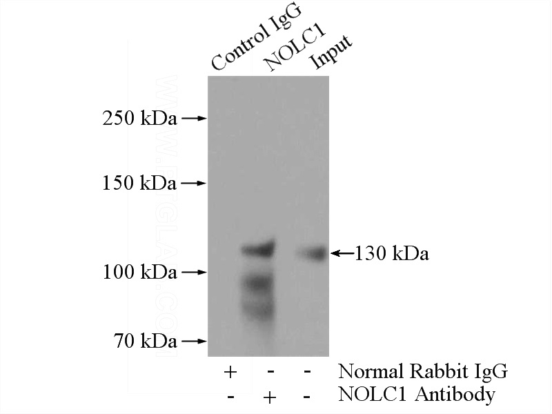 IP Result of anti-P130 (IP:Catalog No:113299, 4ug; Detection:Catalog No:113299 1:500) with HeLa cells lysate 2000ug.