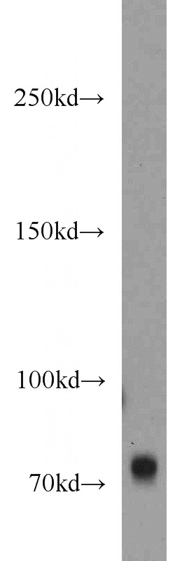 mouse brain tissue were subjected to SDS PAGE followed by western blot with Catalog No:110862(GANP antibody) at dilution of 1:300