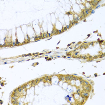 Immunohistochemistry - PMPCB Polyclonal Antibody 