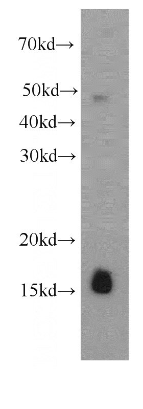 K-562 cells were subjected to SDS PAGE followed by western blot with Catalog No:107210(FHIT antibody) at dilution of 1:500