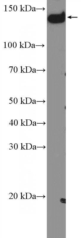 HeLa cells were subjected to SDS PAGE followed by western blot with Catalog No:113945(PLCB3 Antibody) at dilution of 1:600