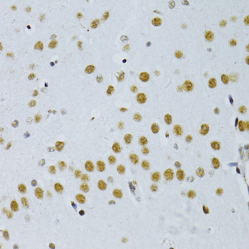 Immunohistochemistry - SNRNP70 Polyclonal Antibody 