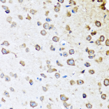 Immunohistochemistry - SERPINA10 Polyclonal Antibody 