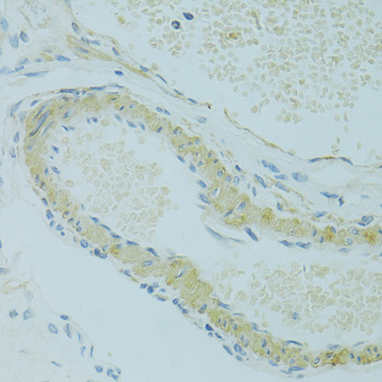 Immunohistochemistry - IFT57 Polyclonal Antibody 