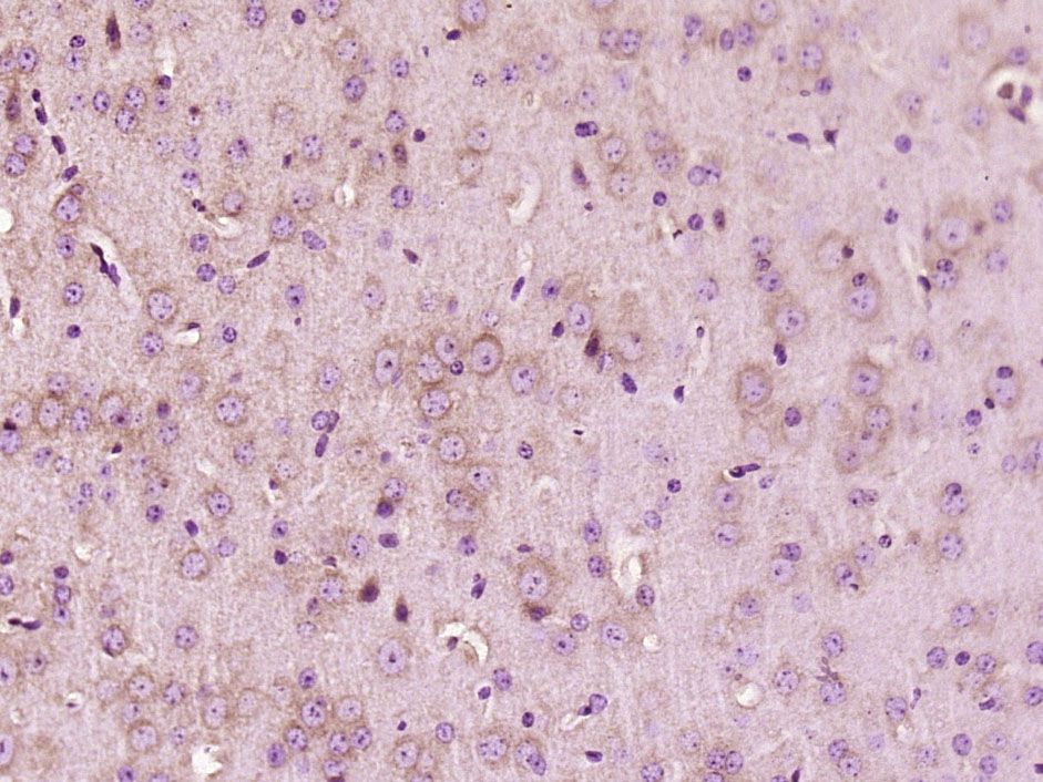 Fig3: Paraformaldehyde-fixed, paraffin embedded (Mouse brain); Antigen retrieval by boiling in sodium citrate buffer (pH6.0) for 15min; Block endogenous peroxidase by 3% hydrogen peroxide for 20 minutes; Blocking buffer (normal goat serum) at 37℃ for 30min; Antibody incubation with (LIPA2) Polyclonal Antibody, Unconjugated at 1:500 overnight at 4℃, followed by a conjugated secondary (sp-0023) for 20 minutes and DAB staining.