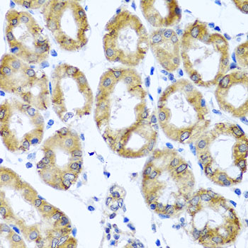 Immunohistochemistry - M6PR Polyclonal Antibody 