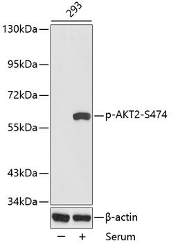Western blot - Phospho-AKT2-S474 pAb 