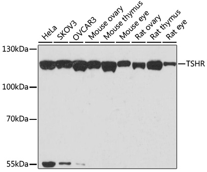 Western blot - TSHR Polyclonal Antibody 