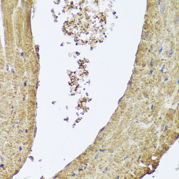 Immunohistochemistry - PIK3C2A Polyclonal Antibody 