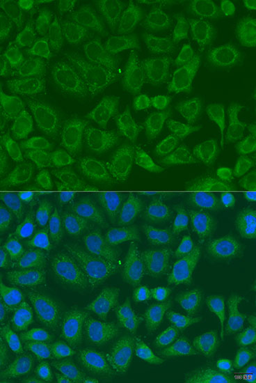 Immunofluorescence - ICK Polyclonal Antibody 