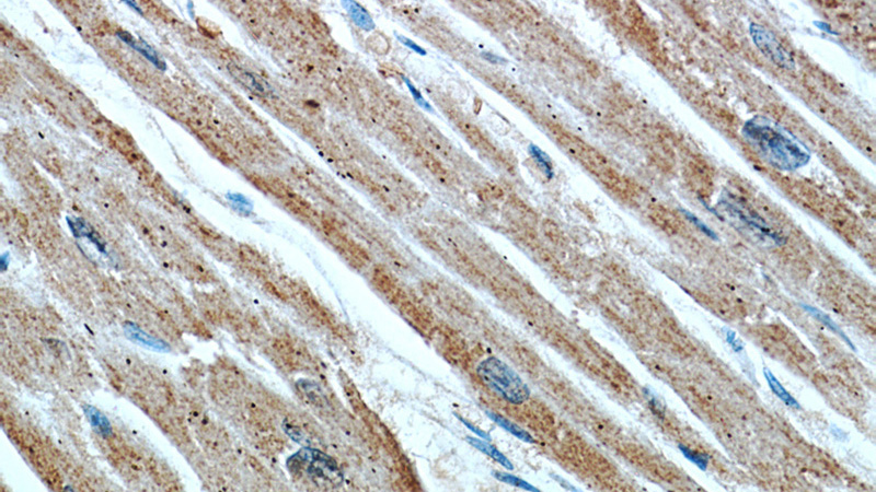 Immunohistochemical of paraffin-embedded human heart using Catalog No:107173(CPT1A antibody) at dilution of 1:50 (under 40x lens)