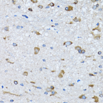 Immunohistochemistry - RARS Polyclonal Antibody 