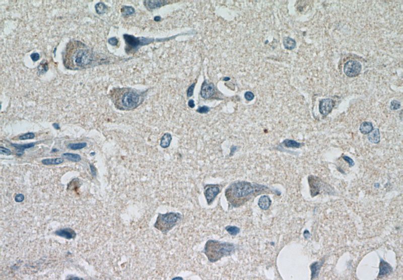 Immunohistochemical of paraffin-embedded human brain using Catalog No:107331(NF200 antibody) at dilution of 1:50 (under 40x lens)