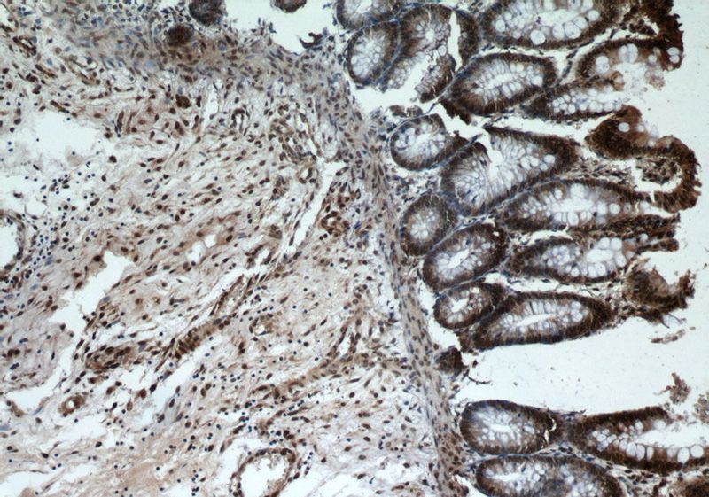 Immunohistochemical of paraffin-embedded human colon using Catalog No:115521(SP1 antibody) at dilution of 1:50 (under 10x lens)