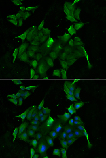 Immunofluorescence - SLC34A1 Polyclonal Antibody 