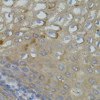 Immunohistochemistry - Mitofusin 2 Polyclonal Antibody 