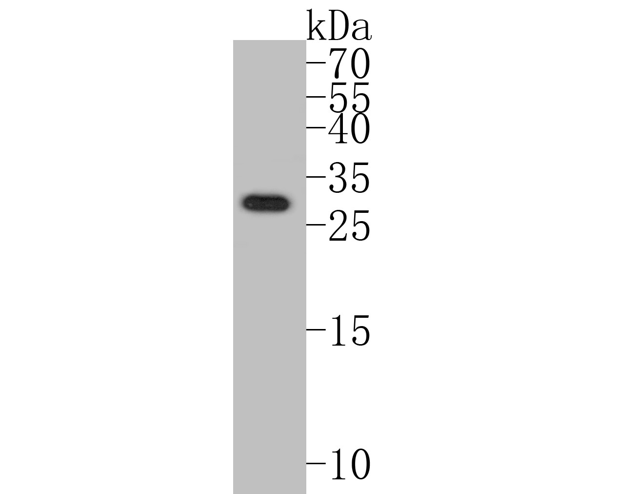 Fig1:; Western blot analysis of TMEM163 on human small intestine tissue lysates. Proteins were transferred to a PVDF membrane and blocked with 5% BSA in PBS for 1 hour at room temperature. The primary antibody ( 1/500) was used in 5% BSA at room temperature for 2 hours. Goat Anti-Rabbit IgG - HRP Secondary Antibody (HA1001) at 1:5,000 dilution was used for 1 hour at room temperature.