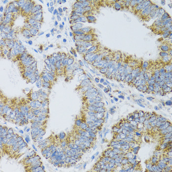 Immunohistochemistry - PDYN Polyclonal Antibody 
