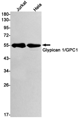 Western blot detection of Glypican 1/GPC1 in Jurkat,Hela cell lysates using Glypican 1/GPC1 Rabbit mAb(1:1000 diluted).Predicted band size:62kDa.Observed band size:55kDa.