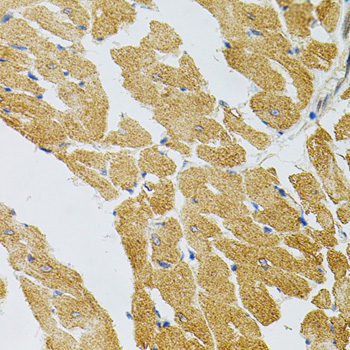 Immunohistochemistry - SYK Polyclonal Antibody 