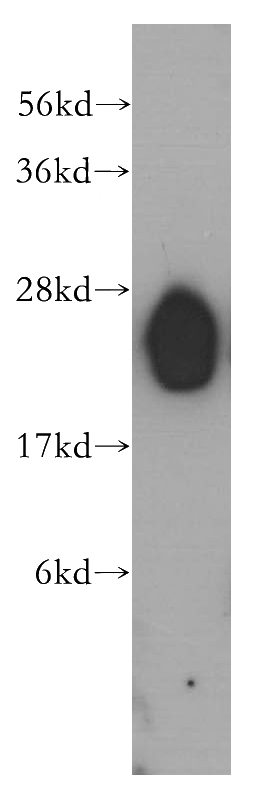 human heart tissue were subjected to SDS PAGE followed by western blot with Catalog No:112237(LIN7B antibody) at dilution of 1:500