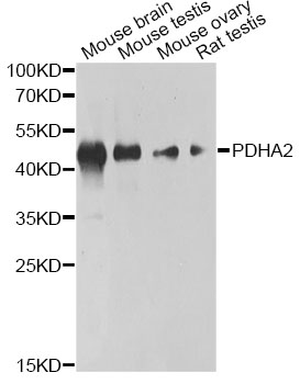 Western blot - PDHA2 Polyclonal Antibody 