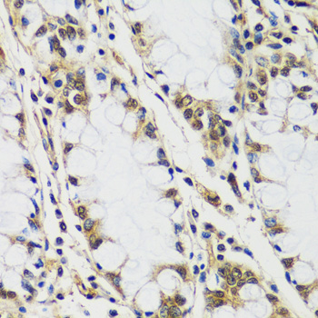 Immunohistochemistry - CASC5 Polyclonal Antibody 