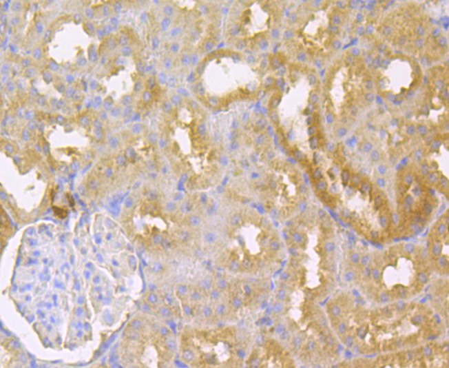 Fig2: Immunohistochemical analysis of paraffin-embedded rat kidney tissue using anti-IL-22 antibody. The section was pre-treated using heat mediated antigen retrieval with sodium citrate buffer (pH 6.0) for 20 minutes. The tissues were blocked in 5% BSA for 30 minutes at room temperature, washed with ddH2O and PBS, and then probed with the antibody at 1/200 dilution, for 30 minutes at room temperature and detected using an HRP conjugated compact polymer system. DAB was used as the chrogen. Counter stained with hematoxylin and mounted with DPX.