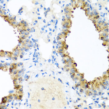 Immunohistochemistry - NIN Polyclonal Antibody 