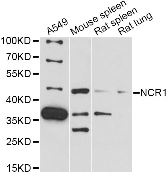 Western blot - NCR1 Polyclonal Antibody 