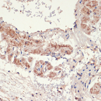 Immunohistochemistry - ADRA1A Polyclonal Antibody 