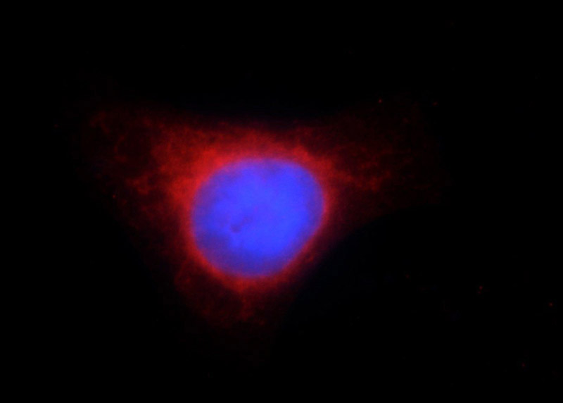 Immunofluorescent analysis of HepG2 cells using Catalog No:109322(CISD2 Antibody) at dilution of 1:50 and Rhodamine-Goat anti-Rabbit IgG