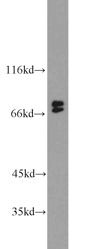 Raji cells were subjected to SDS PAGE followed by western blot with Catalog No:117187(BLNK antibody) at dilution of 1:300