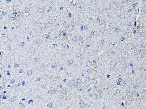 Immunohistochemistry - RYR2 Polyclonal Antibody 