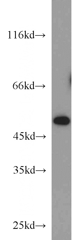Jurkat cells were subjected to SDS PAGE followed by western blot with Catalog No:109624(CTBP1 antibody) at dilution of 1:500
