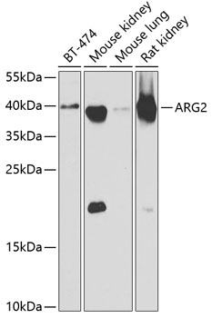 Western blot - ARG2 Polyclonal Antibody 