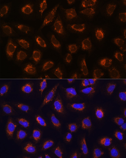 Immunofluorescence - GANAB Polyclonal Antibody 