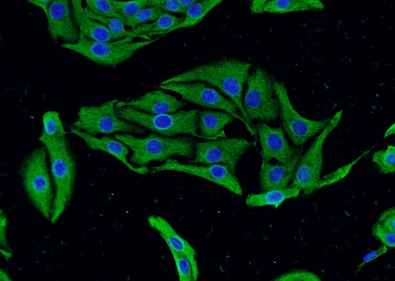 Immunofluorescent analysis of SH-SY5Y cells using Catalog No:108758(CACNA1D Antibody) at dilution of 1:25 and Alexa Fluor 488-congugated AffiniPure Goat Anti-Rabbit IgG(H+L)
