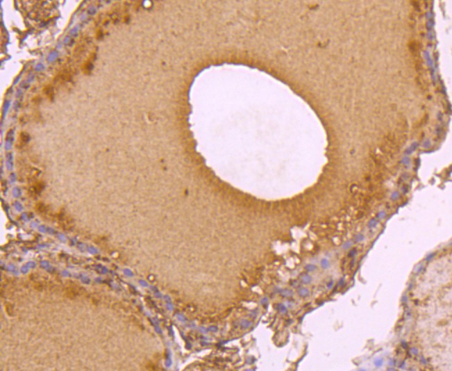 Fig5: Immunohistochemical analysis of paraffin-embedded human thyroid tissue using anti-C14orf93 antibody. Counter stained with hematoxylin.