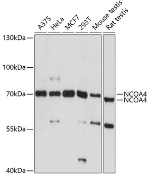 Western blot - NCOA4 Polyclonal Antibody 