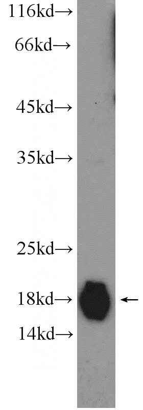 rat heart tissue were subjected to SDS PAGE followed by western blot with Catalog No:111564(HSPB6 Antibody) at dilution of 1:1000