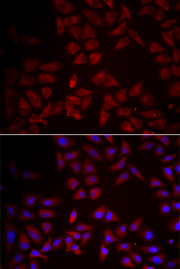 Immunofluorescence - CCL25 Polyclonal Antibody 