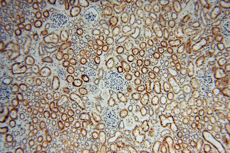 Immunohistochemical of paraffin-embedded human kidney using Catalog No:110299(EDC3 antibody) at dilution of 1:50 (under 10x lens)