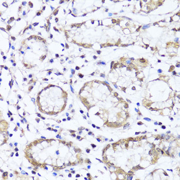 Immunohistochemistry - EGLN1/EGLN2 Polyclonal Antibody 