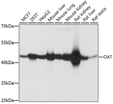Western blot - OAT Polyclonal Antibody 