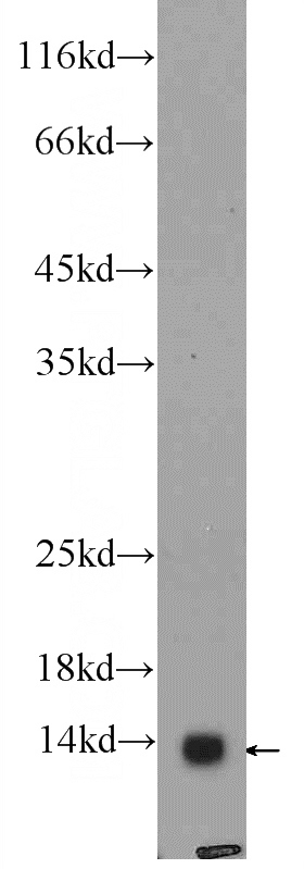 mouse brain tissue were subjected to SDS PAGE followed by western blot with Catalog No:109499(COX7A2L Antibody) at dilution of 1:600