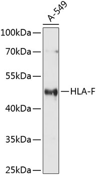 Western blot - HLA-F Polyclonal Antibody 