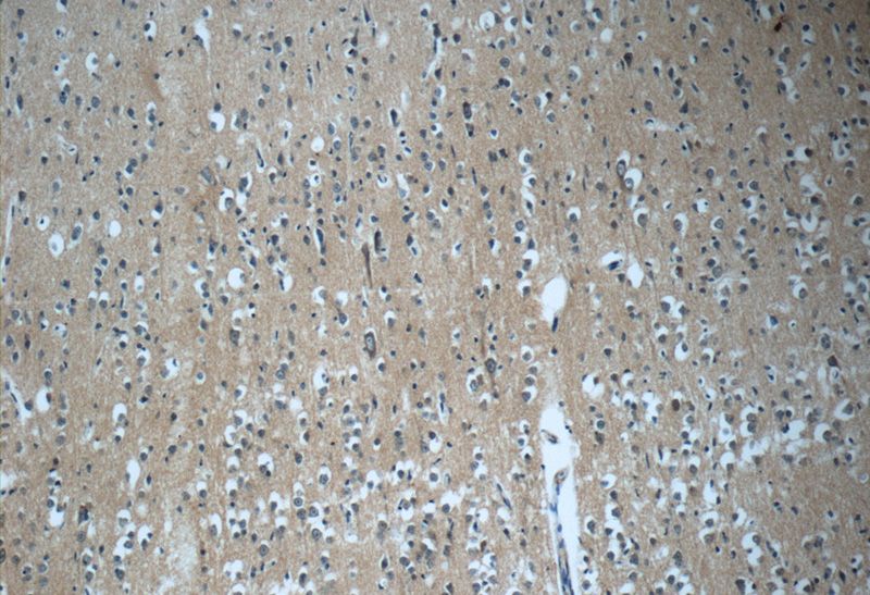 Immunohistochemistry of paraffin-embedded human brain tissue slide using Catalog No:109951(DNAJC6 Antibody) at dilution of 1:50 (under 10x lens)